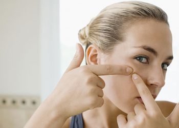 7 Tips Better Ways to Remove Acne on Your Face
