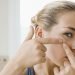 7 Tips Better Ways to Remove Acne on Your Face